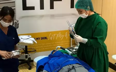 Tanam Rambut hingga Eye Fat Removal Kini Tak Harus ke Luar Negeri